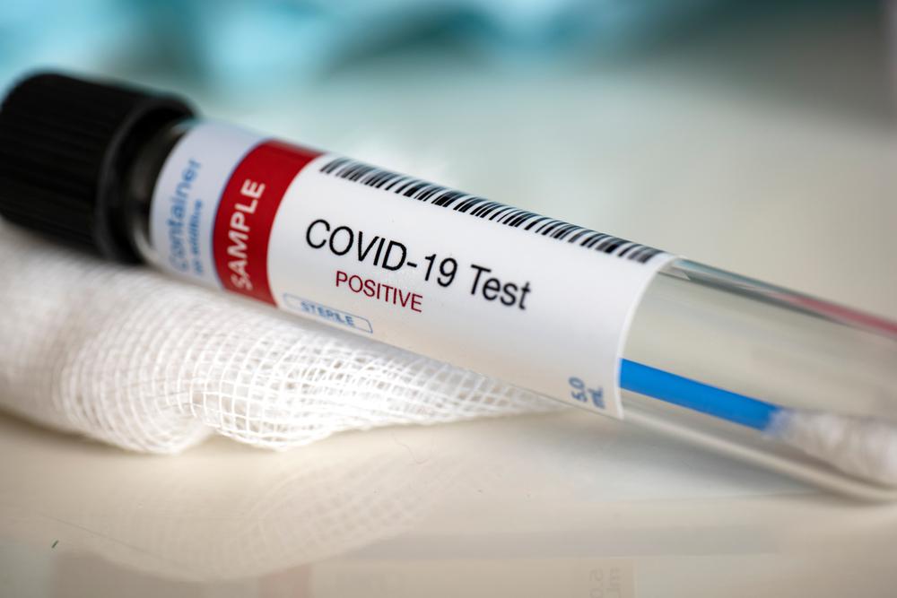 Confirmaron un nuevo caso de coronavirus en Franck - El colono del Oeste